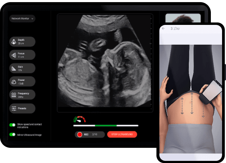 Мобильное приложение для мониторинга беременности